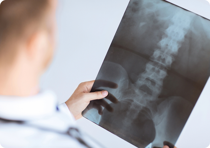 Chiro Xray